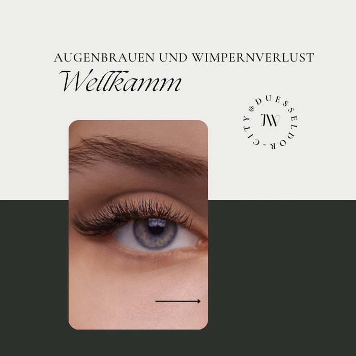 Augenbrauen und Wimpernverlust